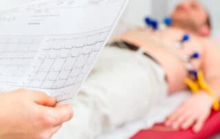 heart arrhythmia symptoms