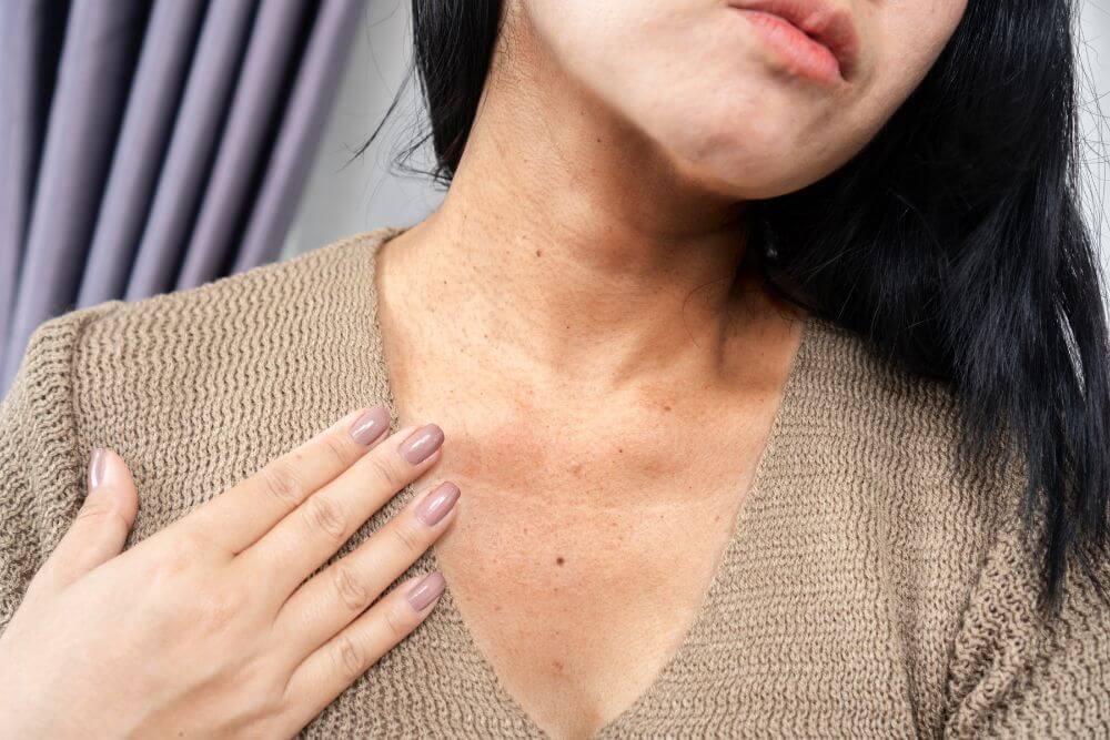 diabetes skin rash